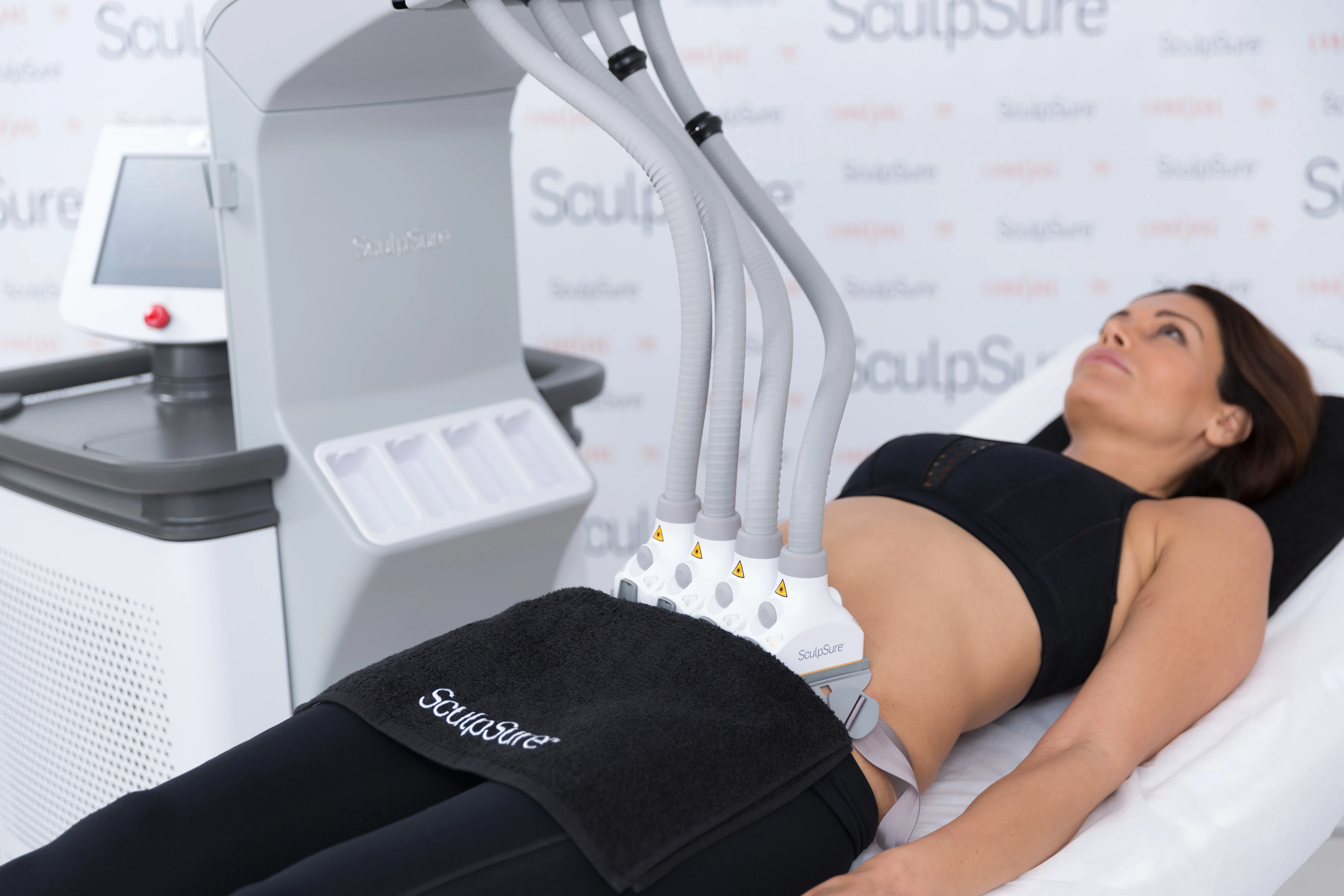 SculpSure body contouring treatment with four abdominal laser applicators and the Cynosure device